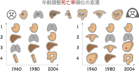 胃癌の罹患率は減っているが、死亡率は高い 臓器別がんの年齢調整死亡率の推移