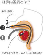 経口、経鼻内視鏡の違い