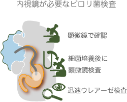 鏡検法、培養法、ウレアーゼ迅速検査は内視鏡要 内視鏡を要するピロリ菌検査