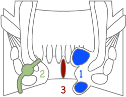 肛門の３大疾患